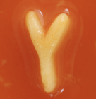 Y